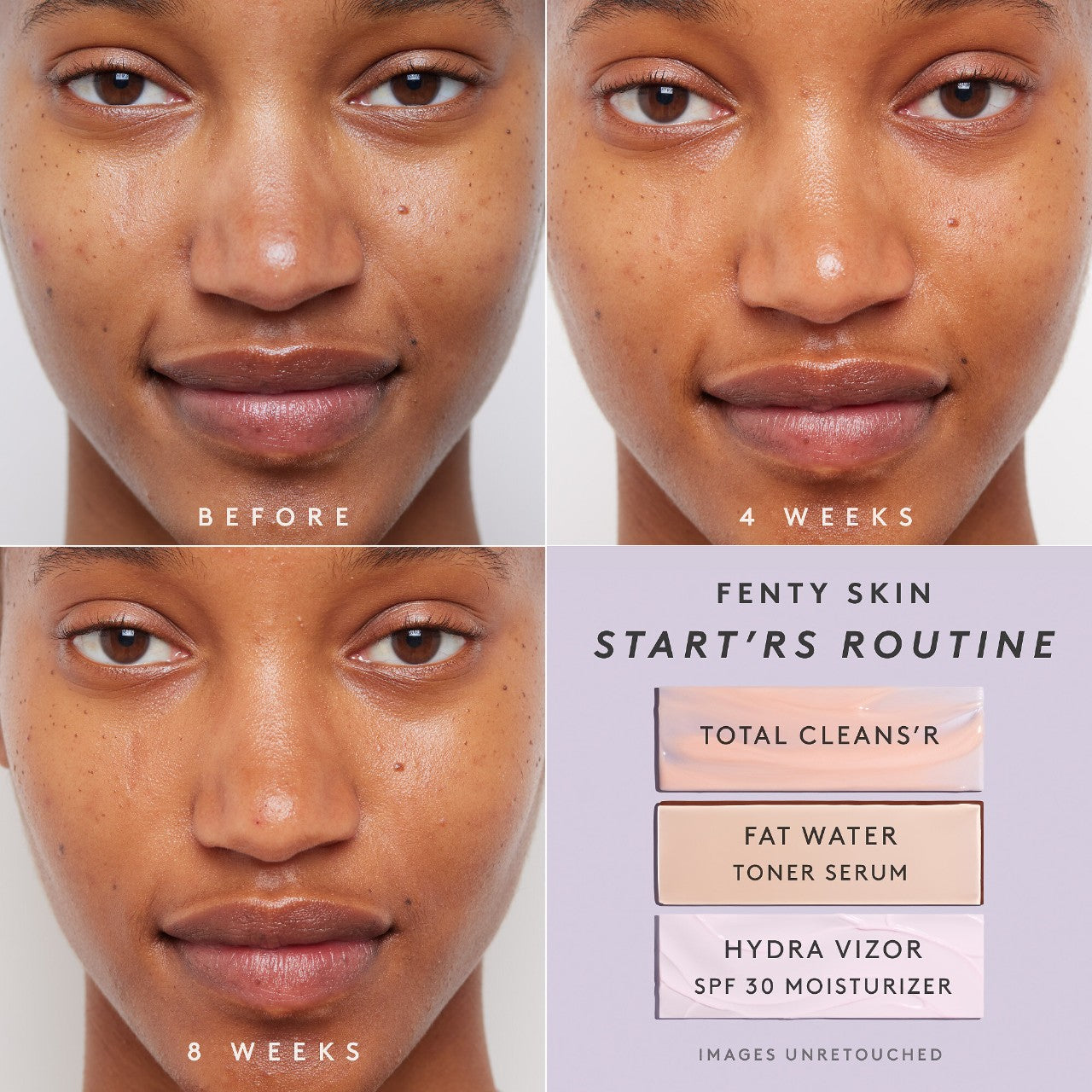 Full-Size Start'r Set