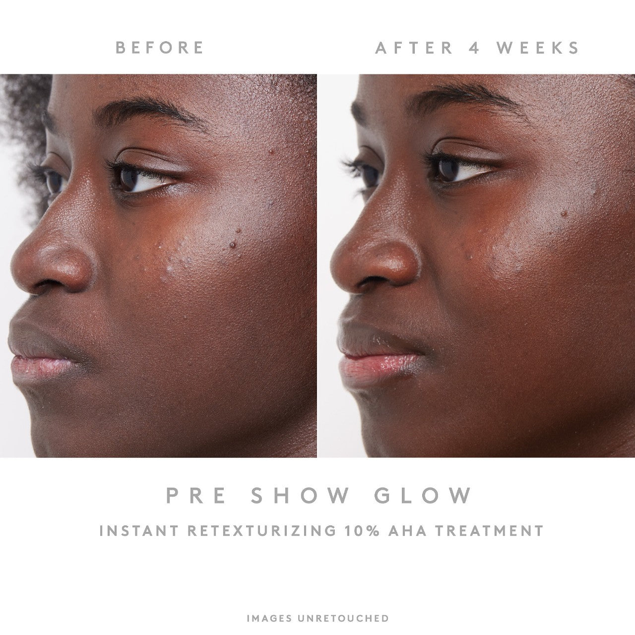 Pre-Show Glow Instant Retexturizing 10% AHA Treatment + Reusable Applicator